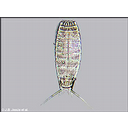 Muestra Imagen Kinorrhincha. Echinoderes sp. (by C. Roldán y J.B. Jesus - Bioimagenes.com) 