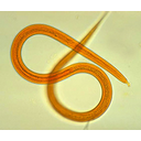 Muestra Imagen Nematoda. Strongyloides sp. (by Tolwweb.org)